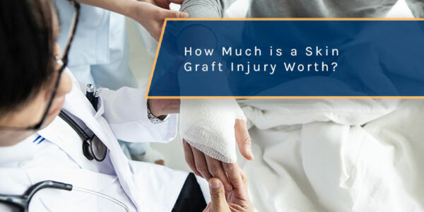 How Much is a Skin Graft Injury Worth in St. Petersburg?